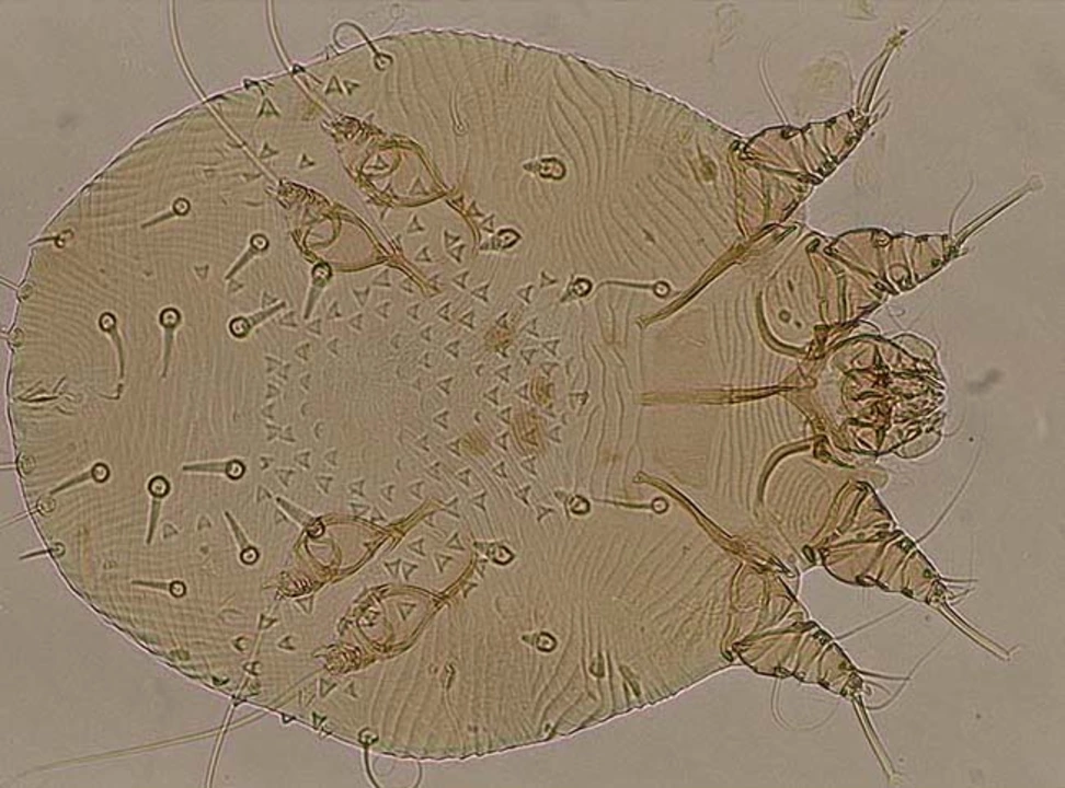 The life cycle of Sarcoptes scabiei and its impact on human health